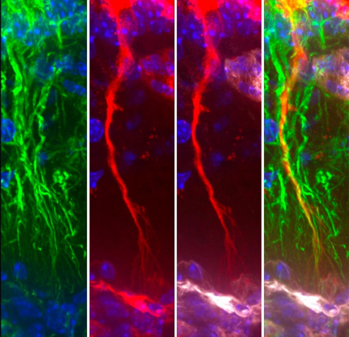 นักวิทยาศาสตร์ค้นพบเซลล์สมองที่ซ่อนอยู่ซึ่งกำจัดโปรตีนที่เป็นพิษของโรคอัลไซเมอร์